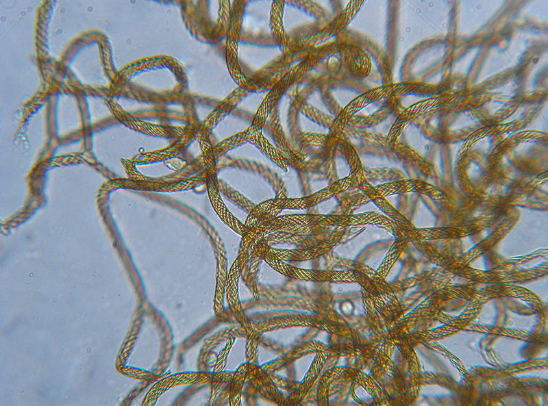 Trichia + Licea?
